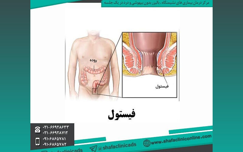 دلیل بیماری های نشیمنگاهی چیست؟