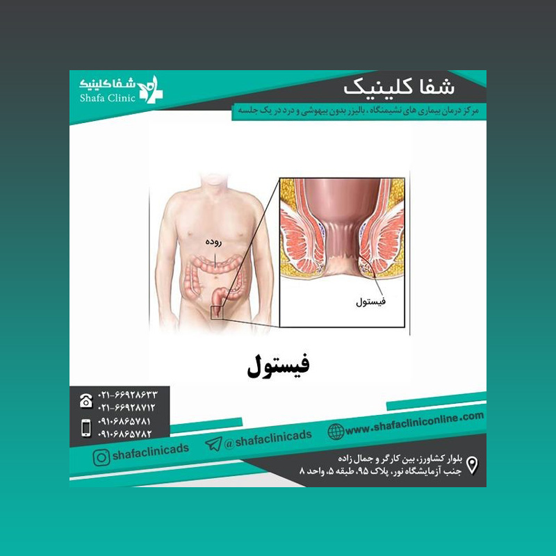 دلیل بیماری های نشیمنگاهی چیست؟