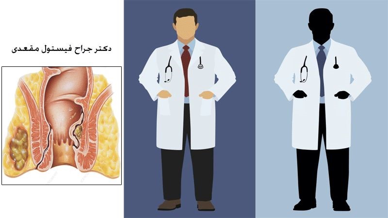 انتخاب دکتر جراح بیماری فیستول مقعدی