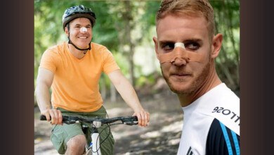 توصیه هایی برای دوچرخه سواری بعد از عمل بینی