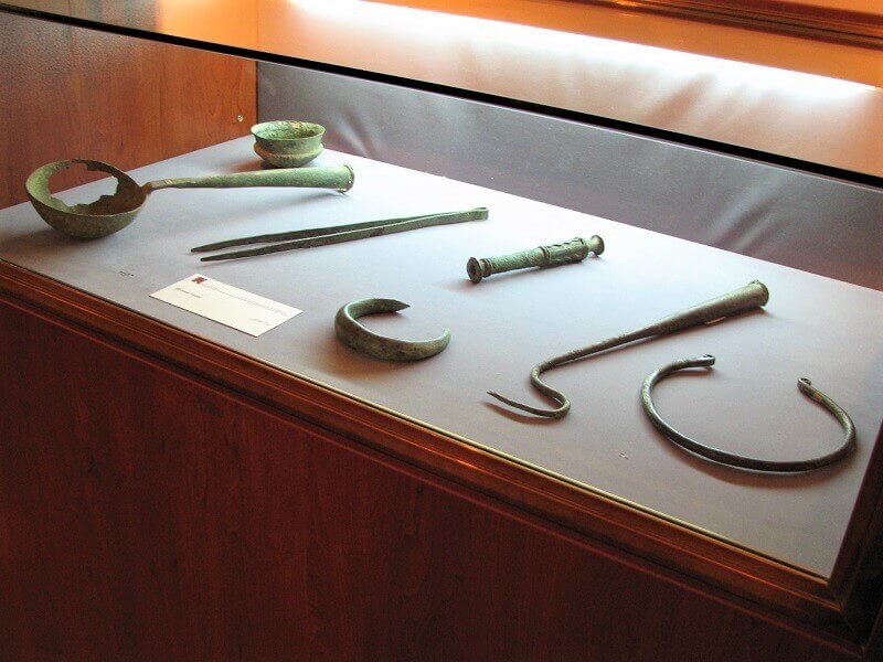 bronze objects from Khorvin