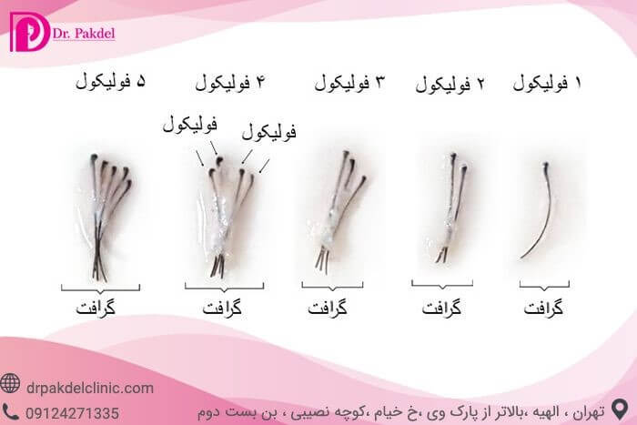 micrografting technique