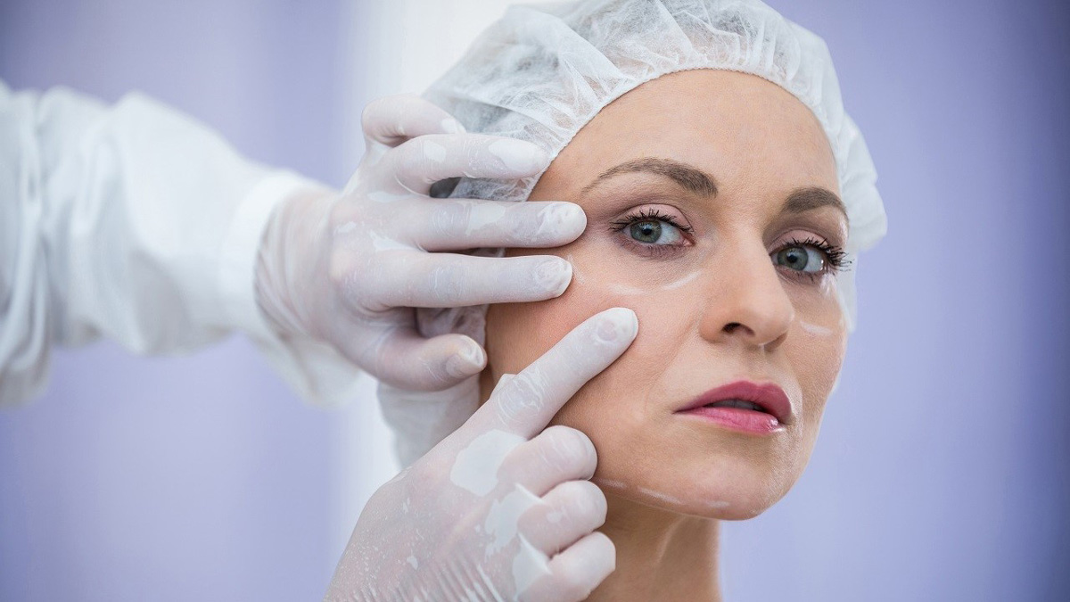 Discover the benefits of Blepharoplasty surgery in Iran